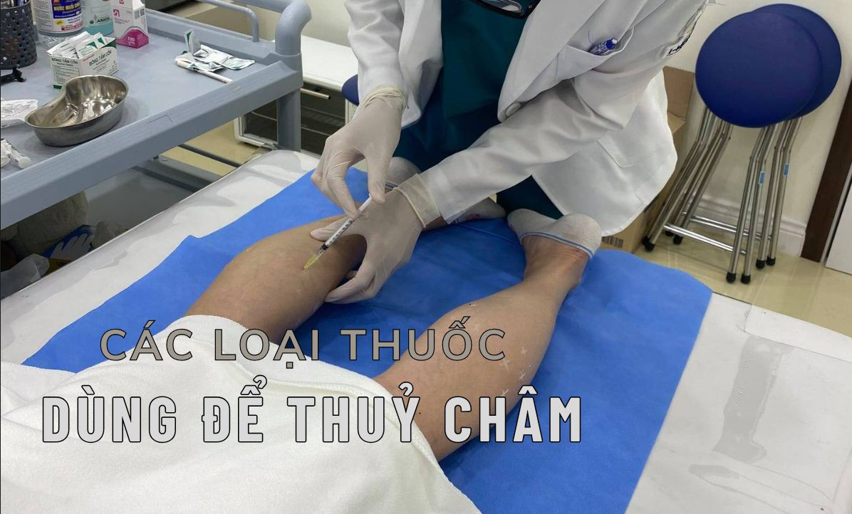 Phương pháp thủy châm